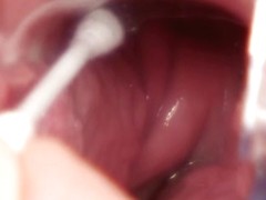 Hot doctor gaping with cumshot